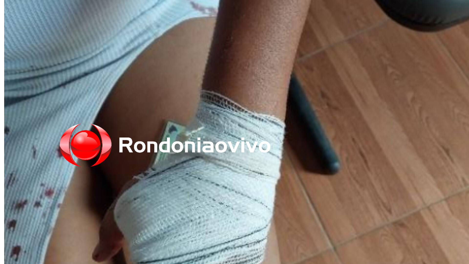 HOSPITALIZADA: Jovem é atacada por  mulheres após tentar defender amiga em tabacaria 