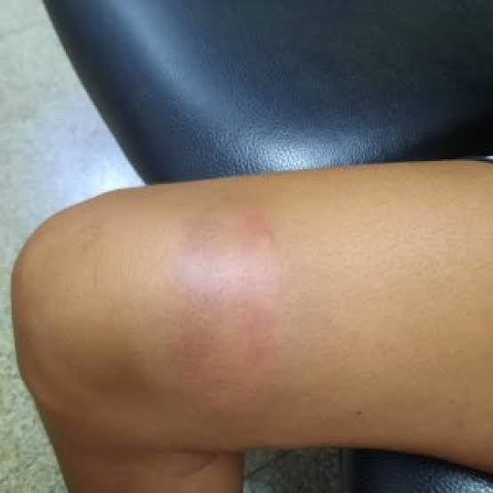 DIA DA MULHER: Ao invés de presente, marido dá surra em esposa e vai preso 