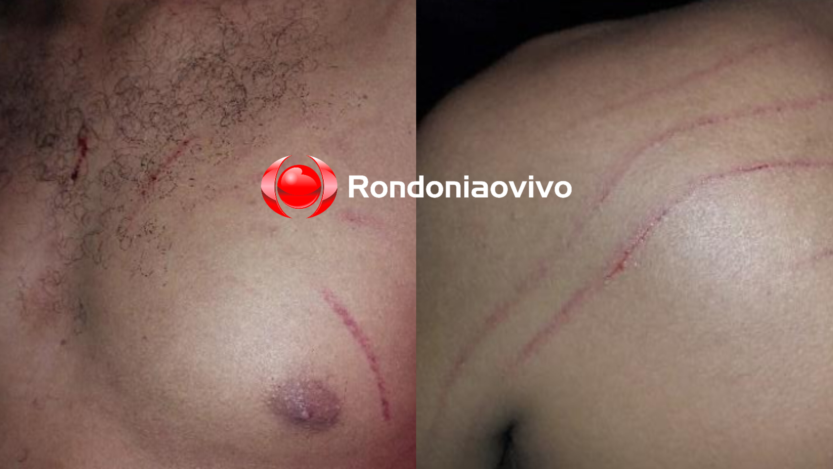 CHAMOU A PM: Mulher embriagada é acusada de espancar o marido 