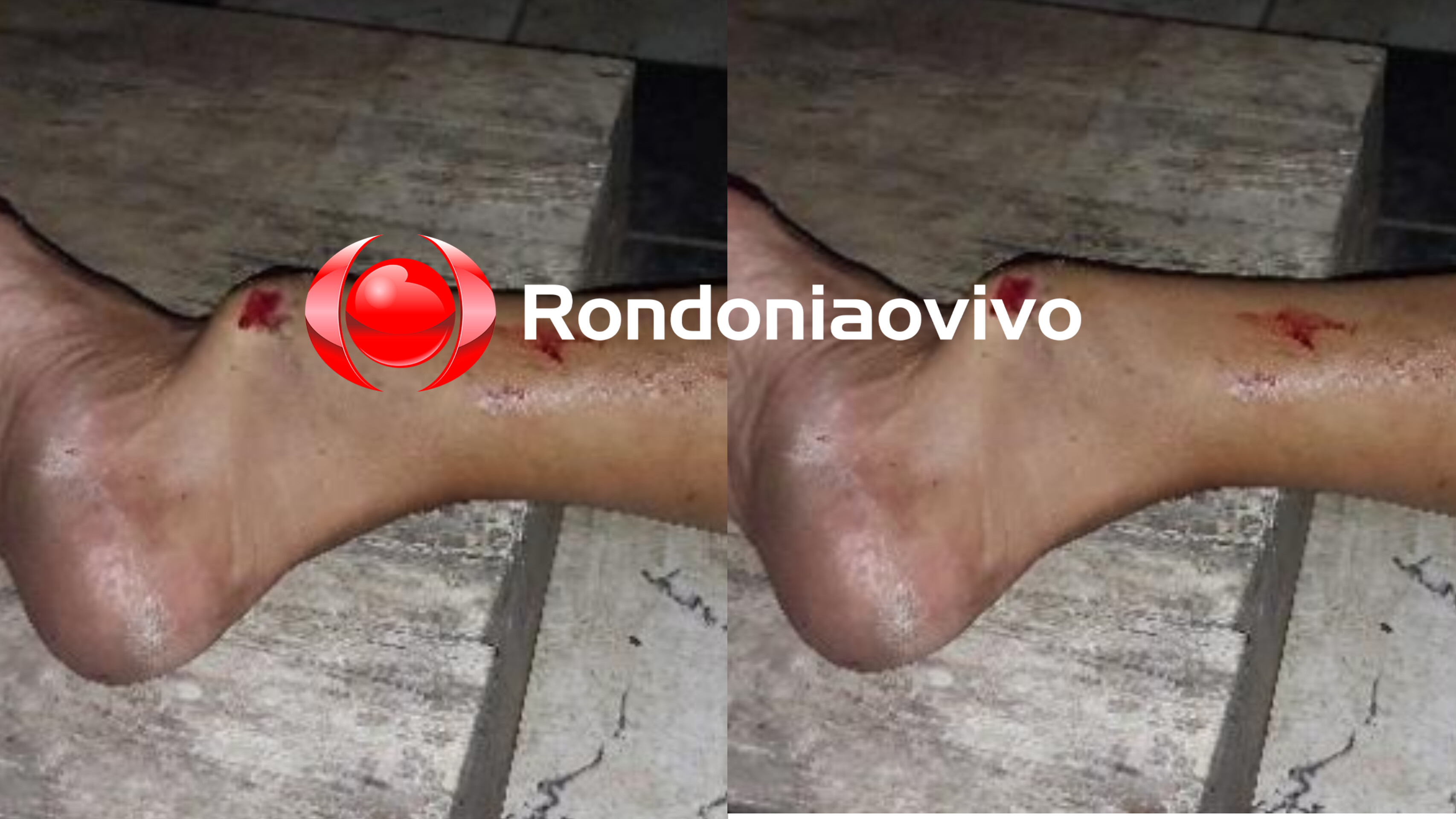 FRATURAS: Homem leva surra após ser acusado de passar a mão na mulher de amigo em bar