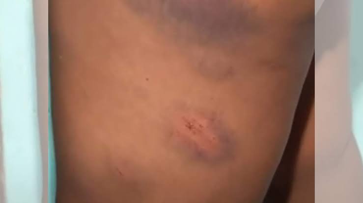 COVARDIA: Empresário surra mulher que descobriu caso dele com adolescente 