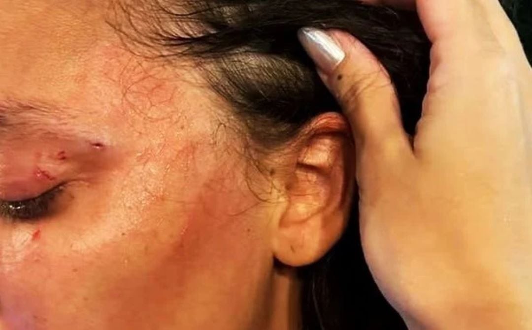 DESESPERADA: Jovem sai correndo na rua pedindo socorro ao ser agredida por marido 