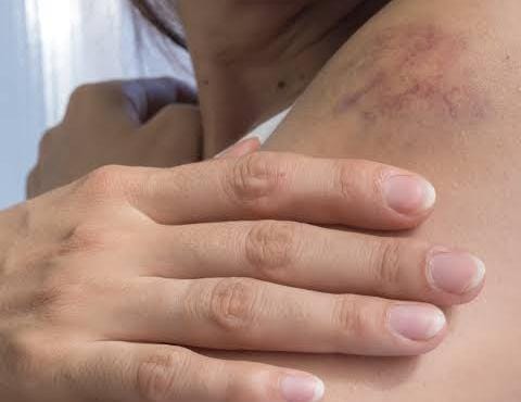 DENTRO DE CASA: Mulher é agredida pelo ex-marido ao negar dinheiro para comprar droga