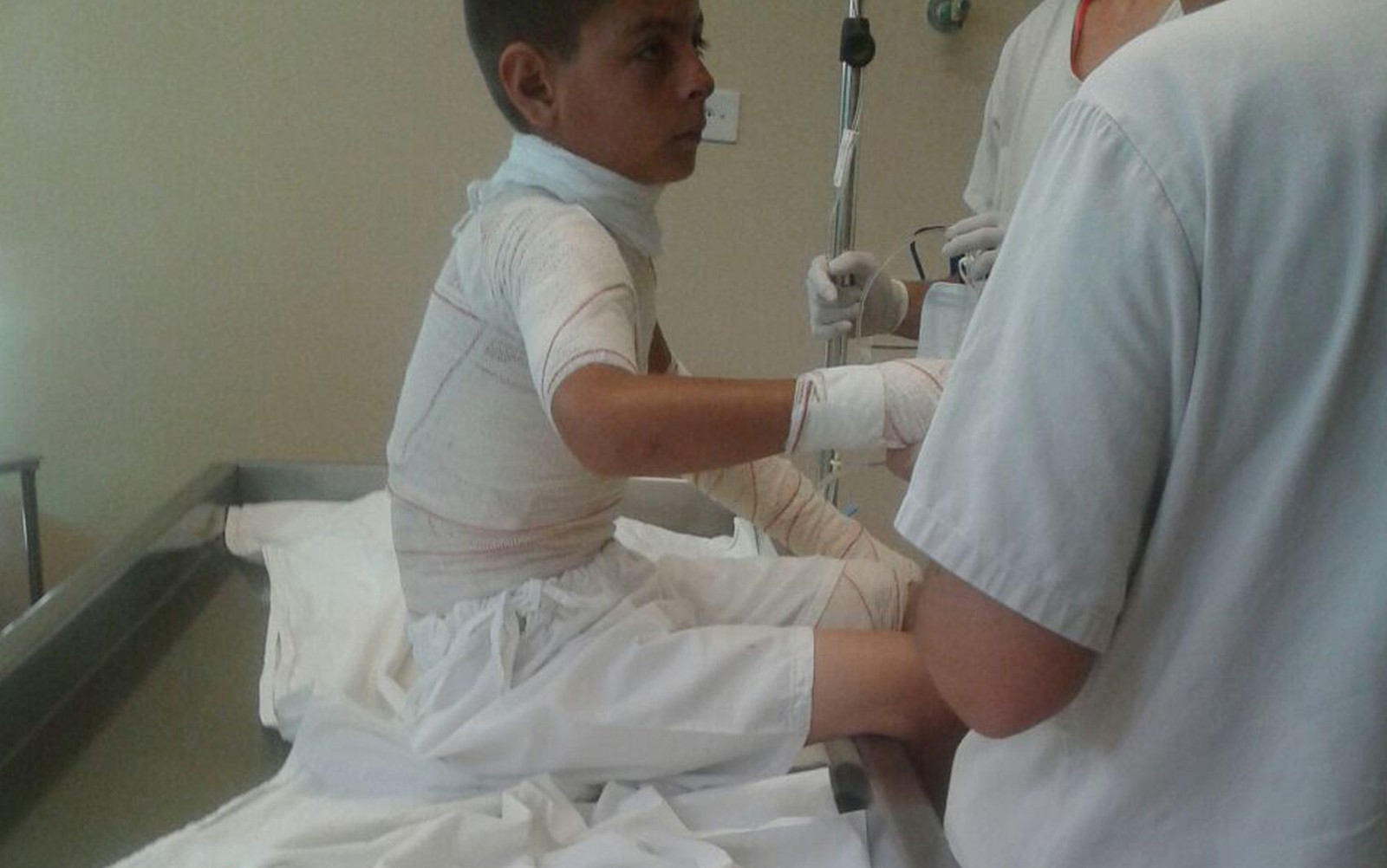 Menino leva choque de alta-tensão ao soltar soltar pipa com fio de cerca elétrica