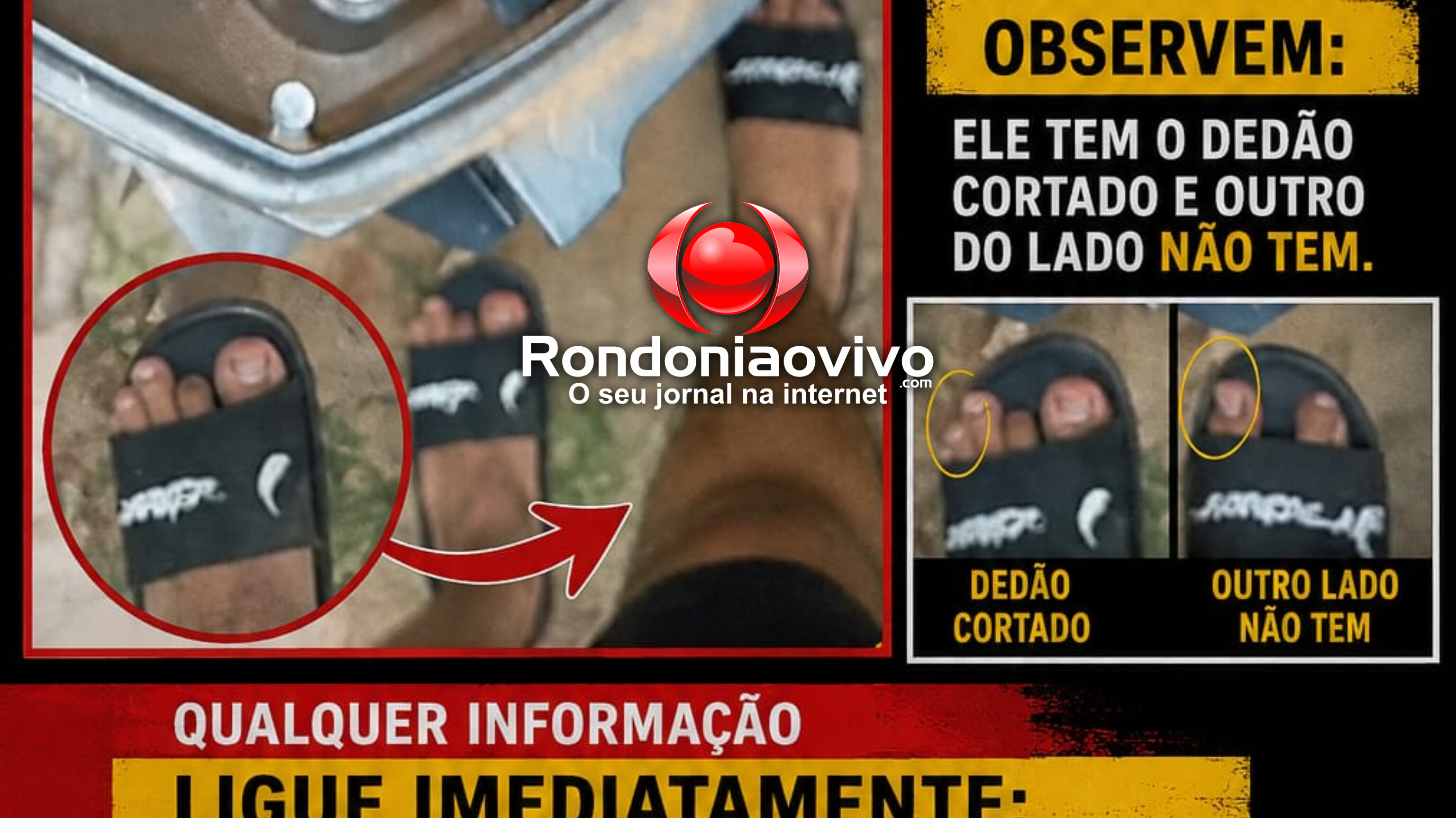 DEDO CORTADO: Dono divulga detalhe de ladrão e oferece recompensa de R$ 10 mil