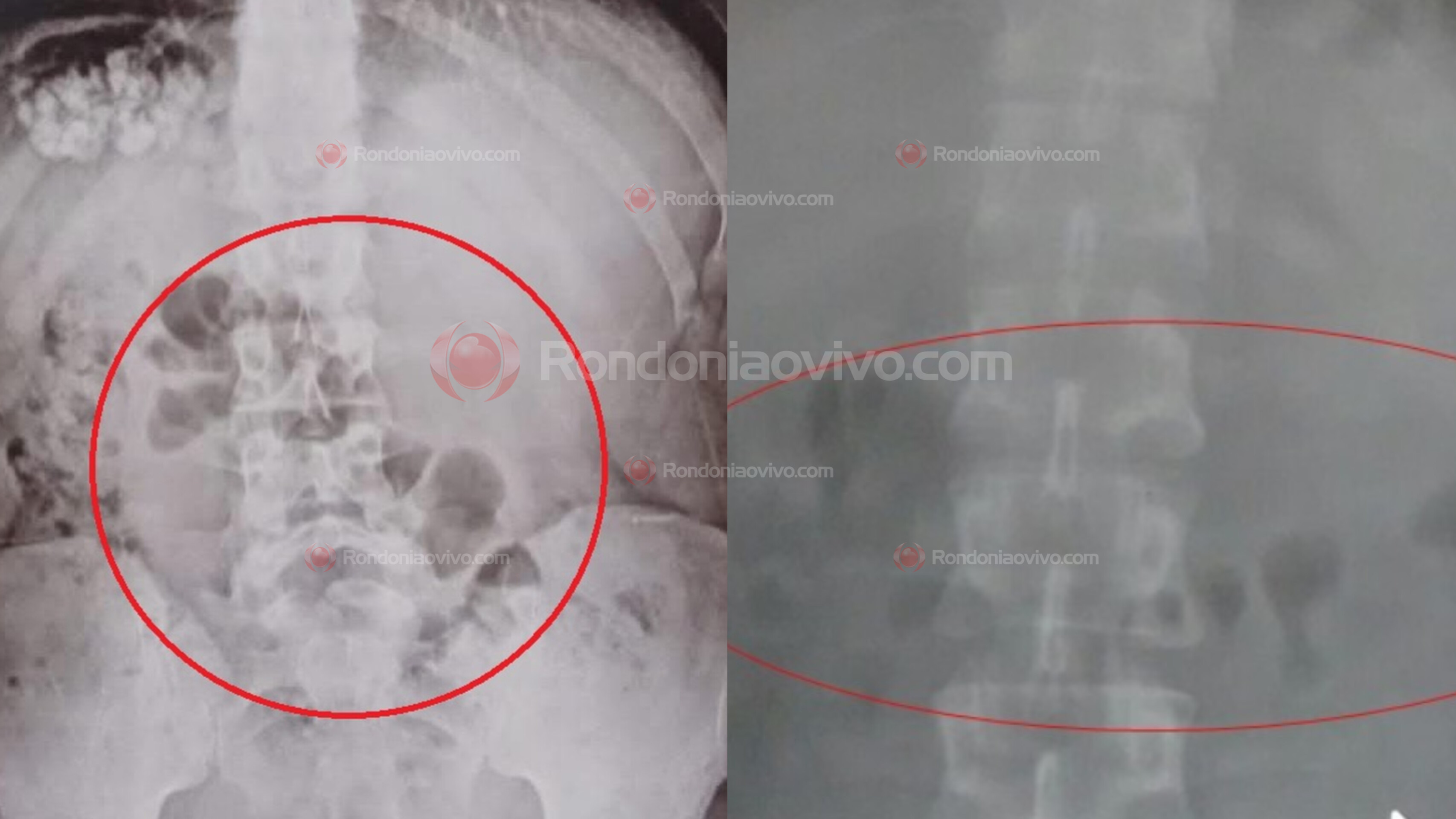 DETECTADAS NO RAIO-X: Mulheres são flagradas em presídio com drogas no estômago e partes íntimas