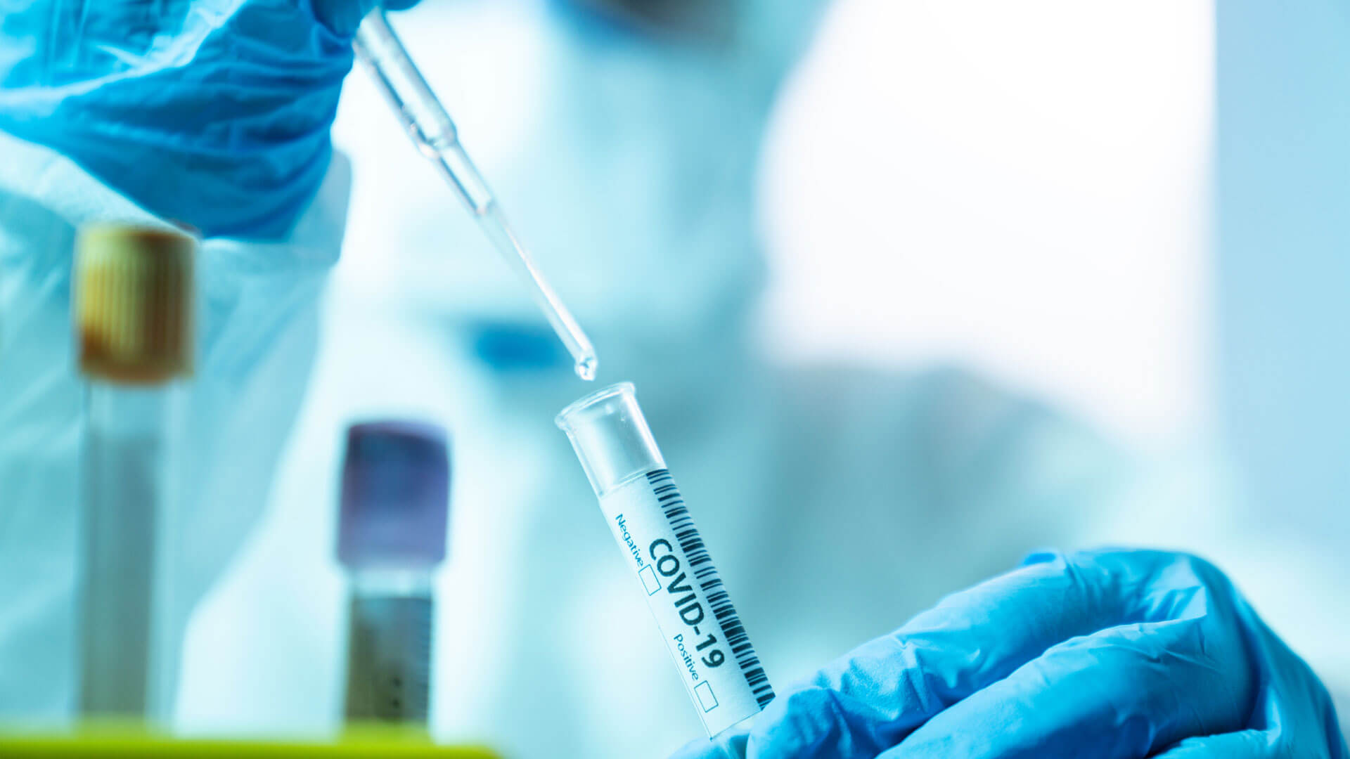 COVID-19: Rondônia não registra morte e 340 casos são confirmados