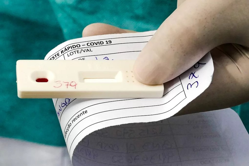 NORMALIDADE: Rondônia registra 57 casos de Covid-19 e nenhuma morte