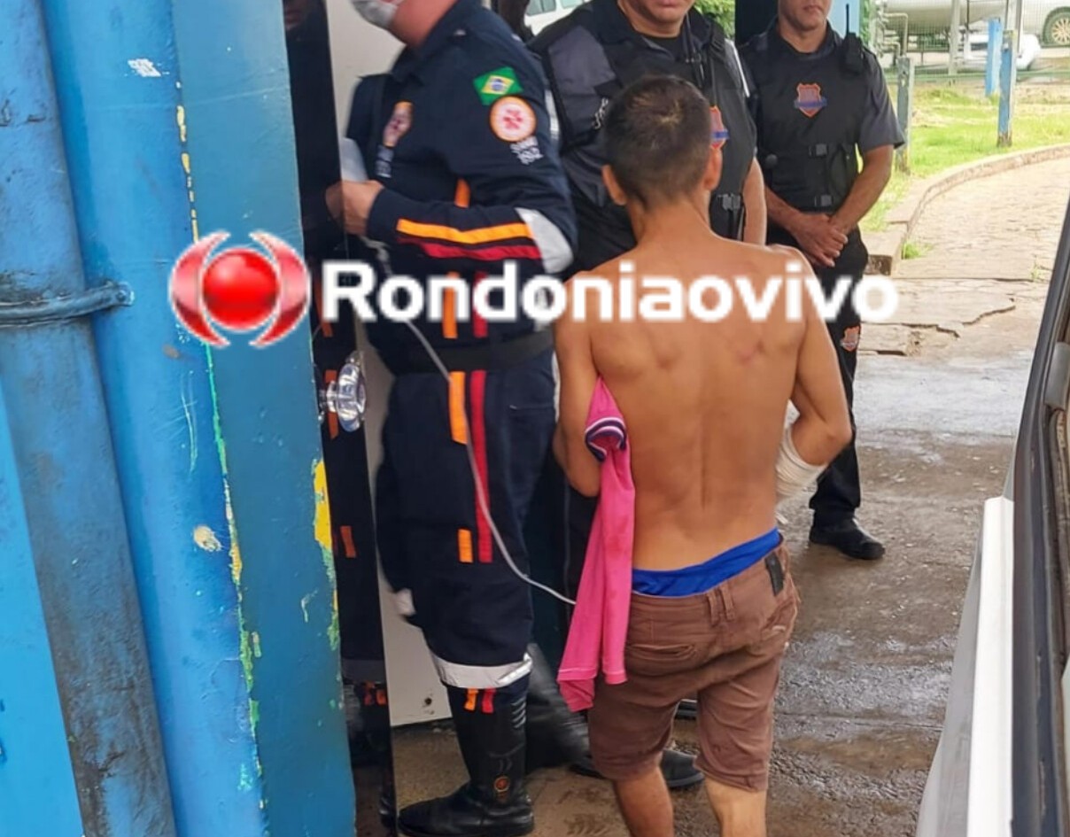 CASTIGADO: Homem é baleado na mão ao ser abordado por vítima de roubo 