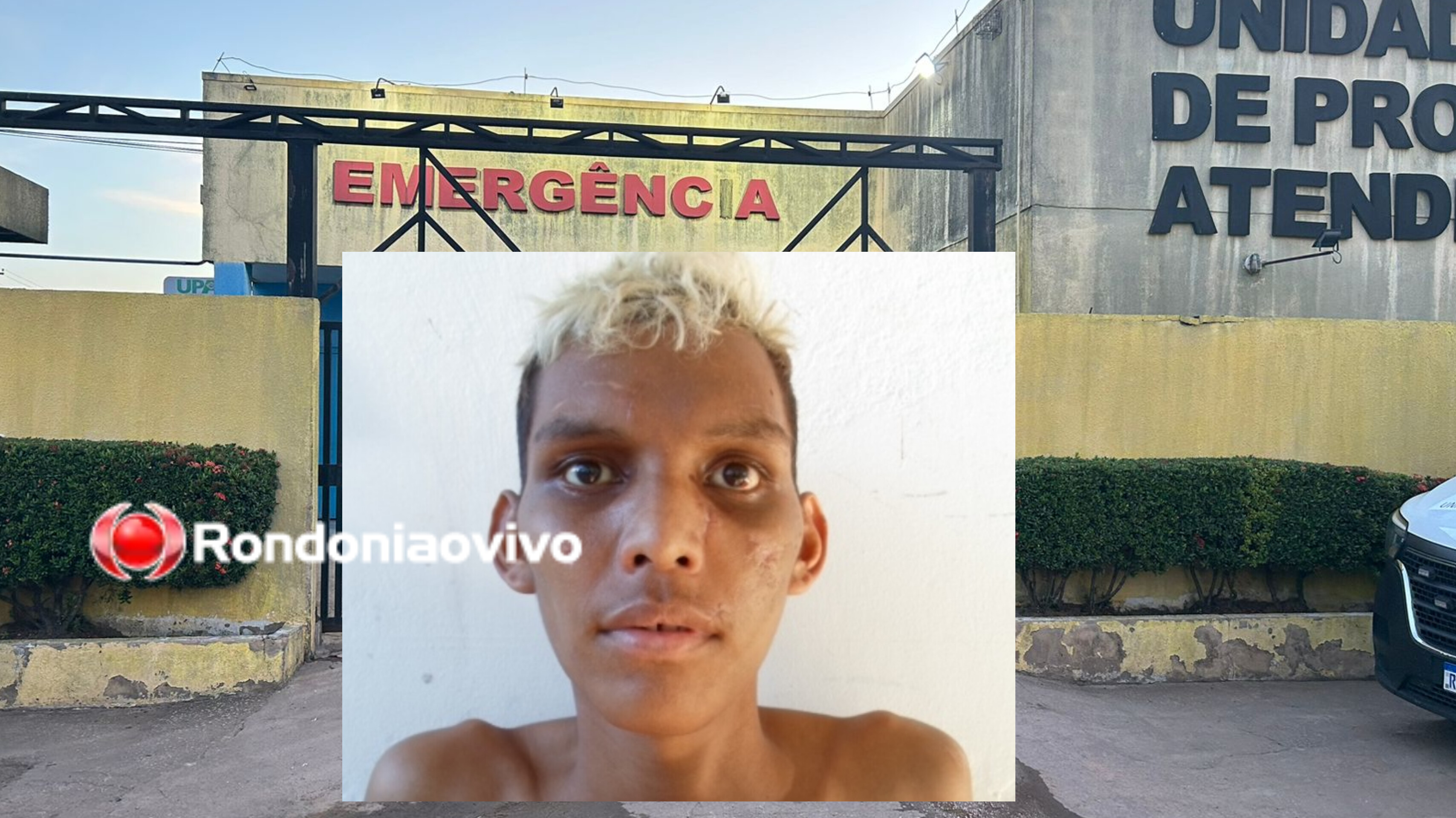 PORTO MADERO: Jovem é baleado no olho em condomínio na zona Leste 