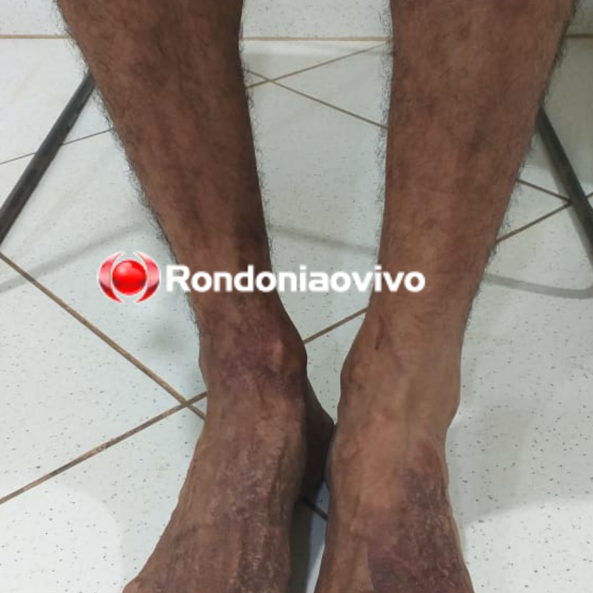 TENTATIVA DE HOMICÍDIO: PM prende homem que atacou irmão no Porto Cristo 