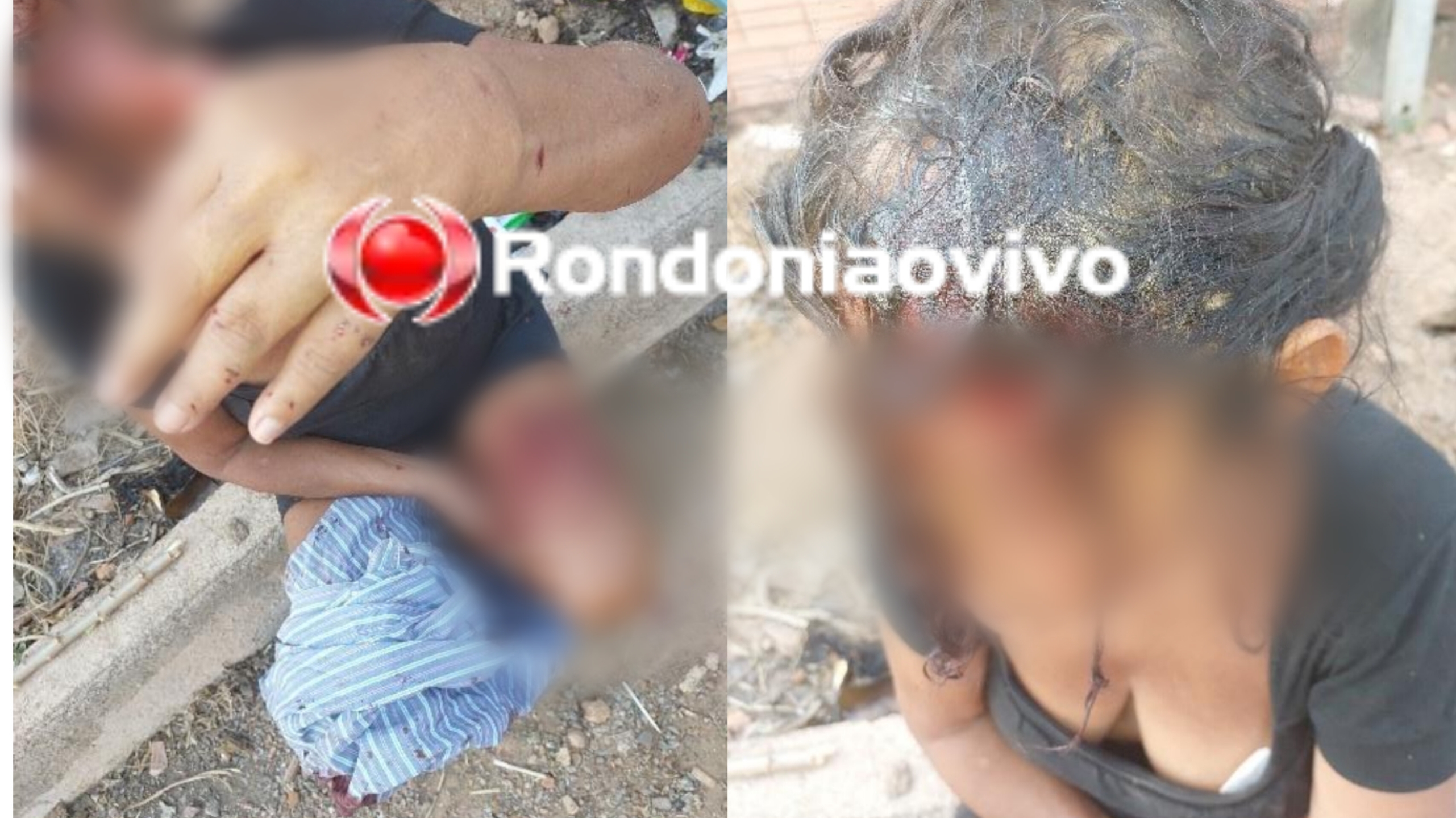 COVARDIA: Mulher é atacada a pauladas por não deixar marido usar drogas em casa 