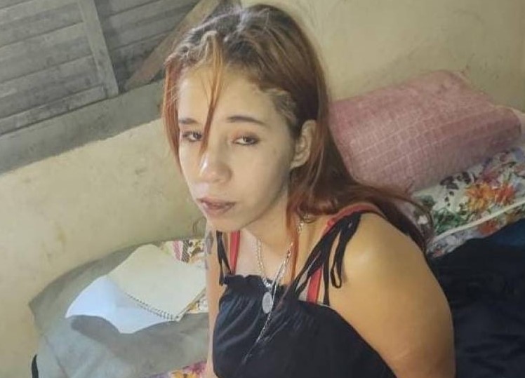 PRECISA DE AJUDA: Jovem fica viúva e perde uma perna em acidente e tem dificuldades