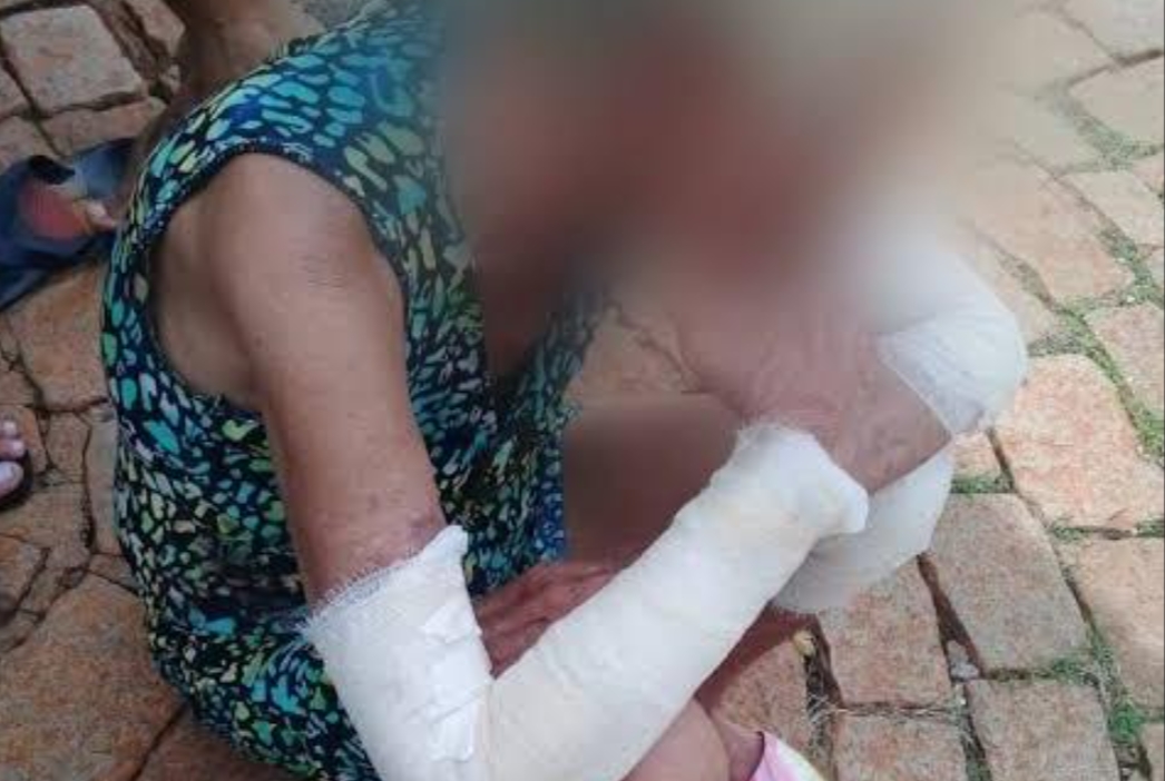 COVARDIA: Idosa de 71 anos é agredida pelo próprio filho com pedaço de madeira