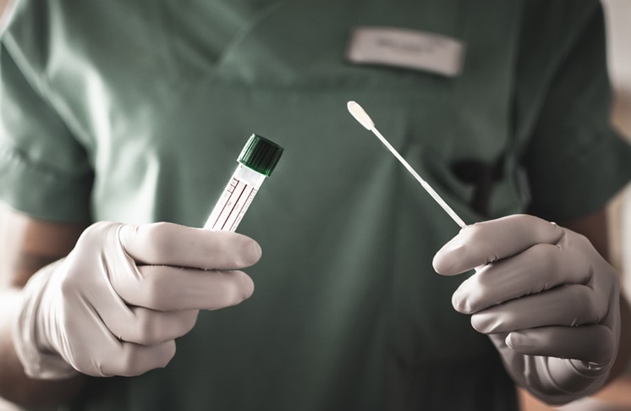 SEM MORTES: Agevisa informa que Rondônia registrou 54 novos casos de covid-19