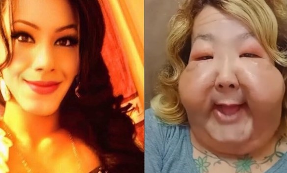 ESTÉTICA COM SEGURANÇA: Caso de Juju do Pix reacende alerta sobre riscos de procedimentos clandestinos