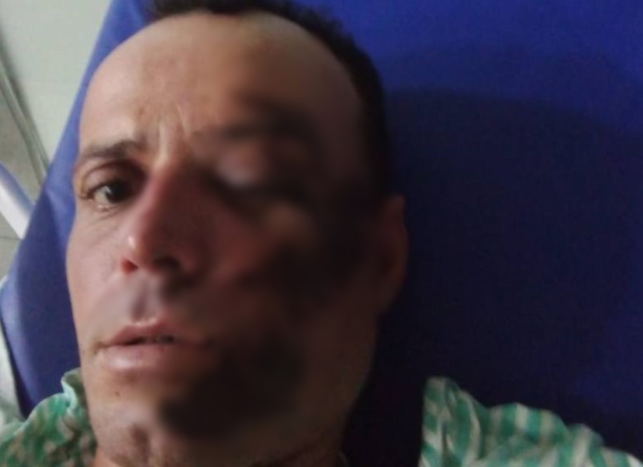 QUEDA: Homem sofre acidente de moto em quebra-molas sem sinalização