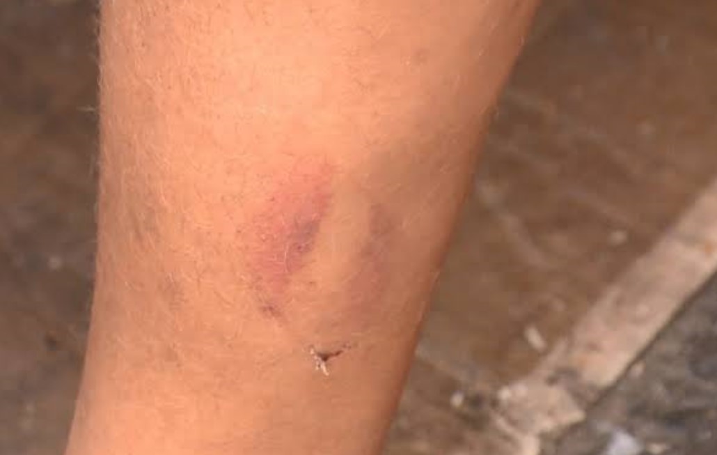 SEM NOÇÃO: Marido leva 'ex-amante' para morar em casa e surra esposa que não aceitou