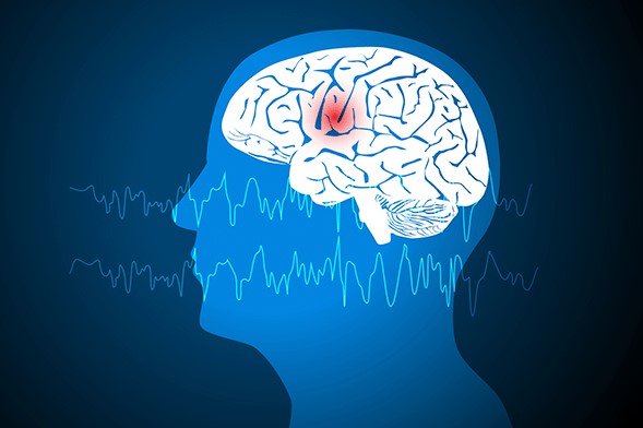 EVENTO: Palestras conscientizam comunidade sobre a epilepsia