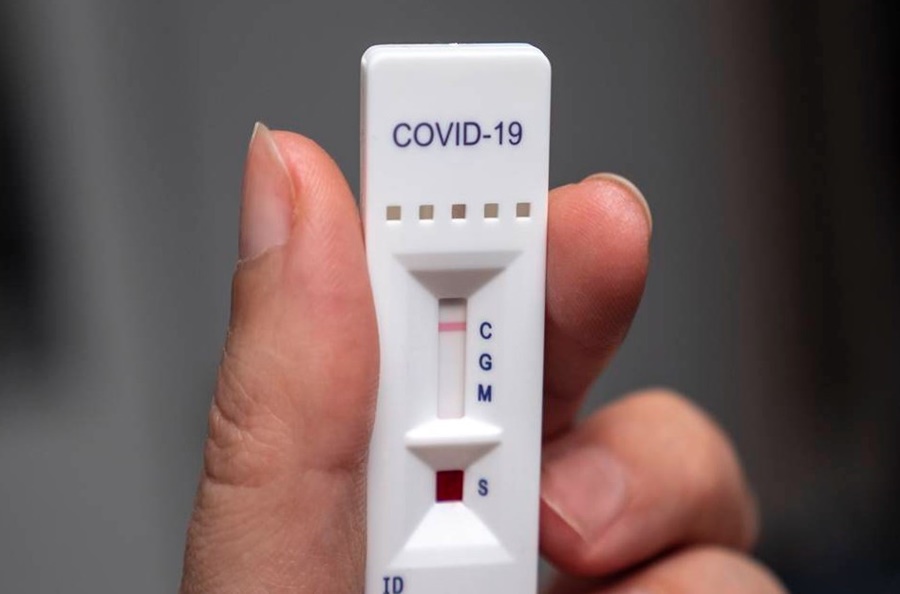 BOLETIM: Rondônia registra 119 novos casos de Covid-19 e nenhuma morte