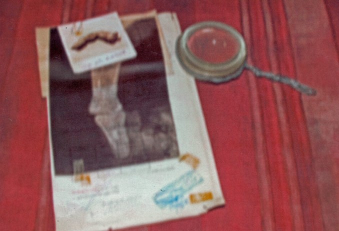 SINISTRO: Dedo enorme de 40 cm pode provar existência de 'gigantes' no passado