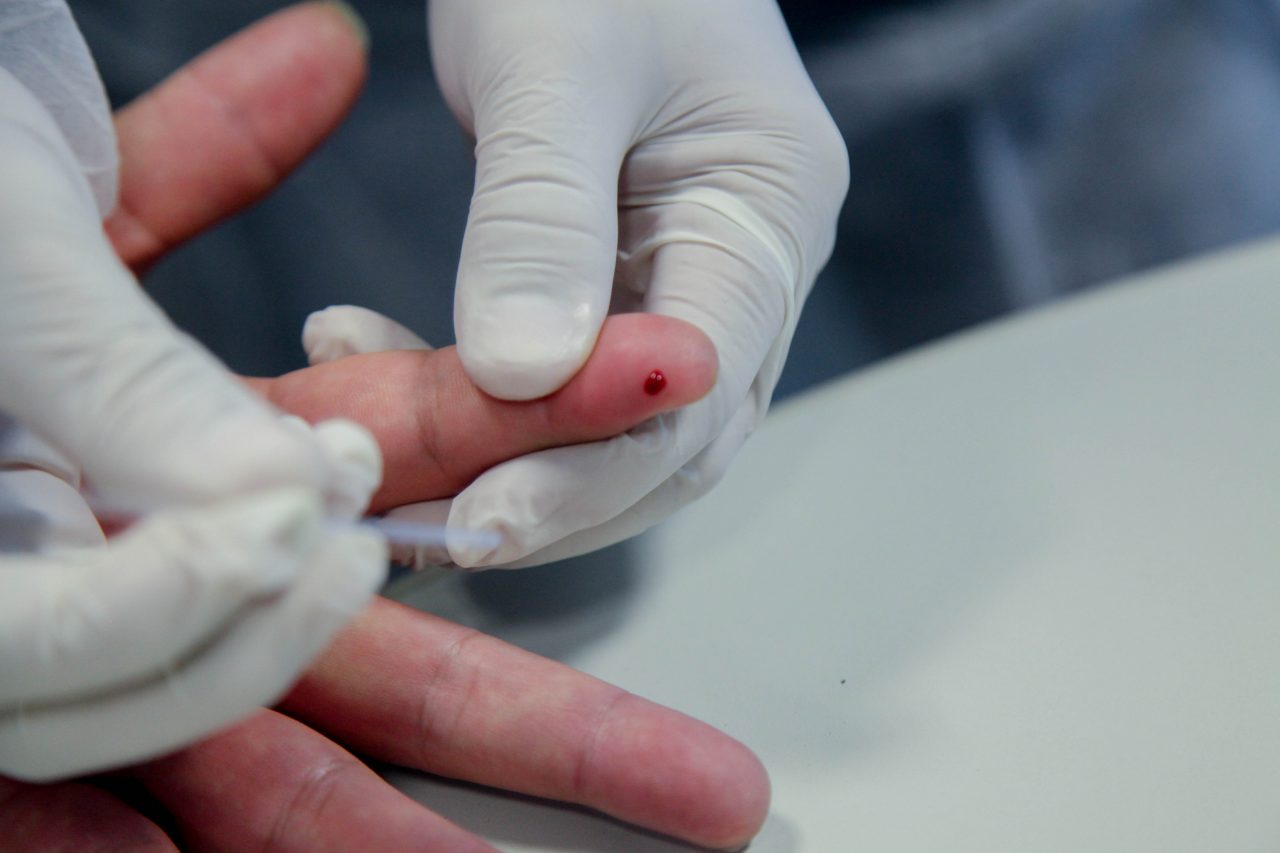 BOLETIM COVID: Rondônia registra 1.078 casos e quatro mortes na quarta-feira (2)