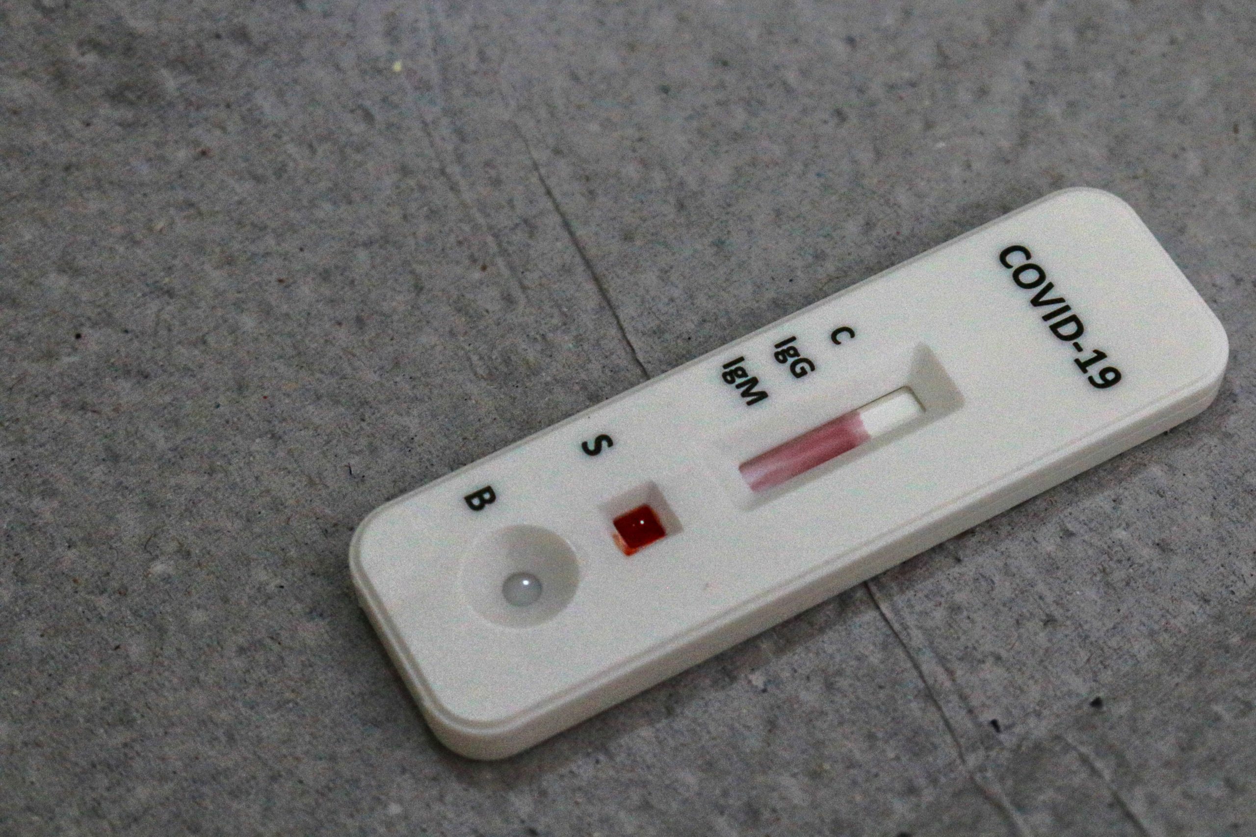 VÍRUS: Rondônia registra uma morte por covid-19 e 230 casos no domingo (10)