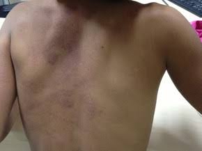 ESPANCADA: Criança de sete anos é encontrada sangrando pelo nariz e pai acaba preso