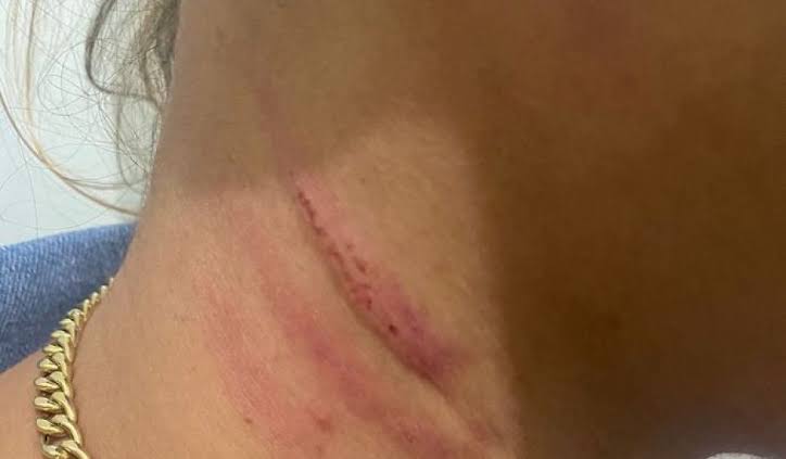 'NÃO SE META': Mulher acaba surrada por tentar intervir em briga de casal