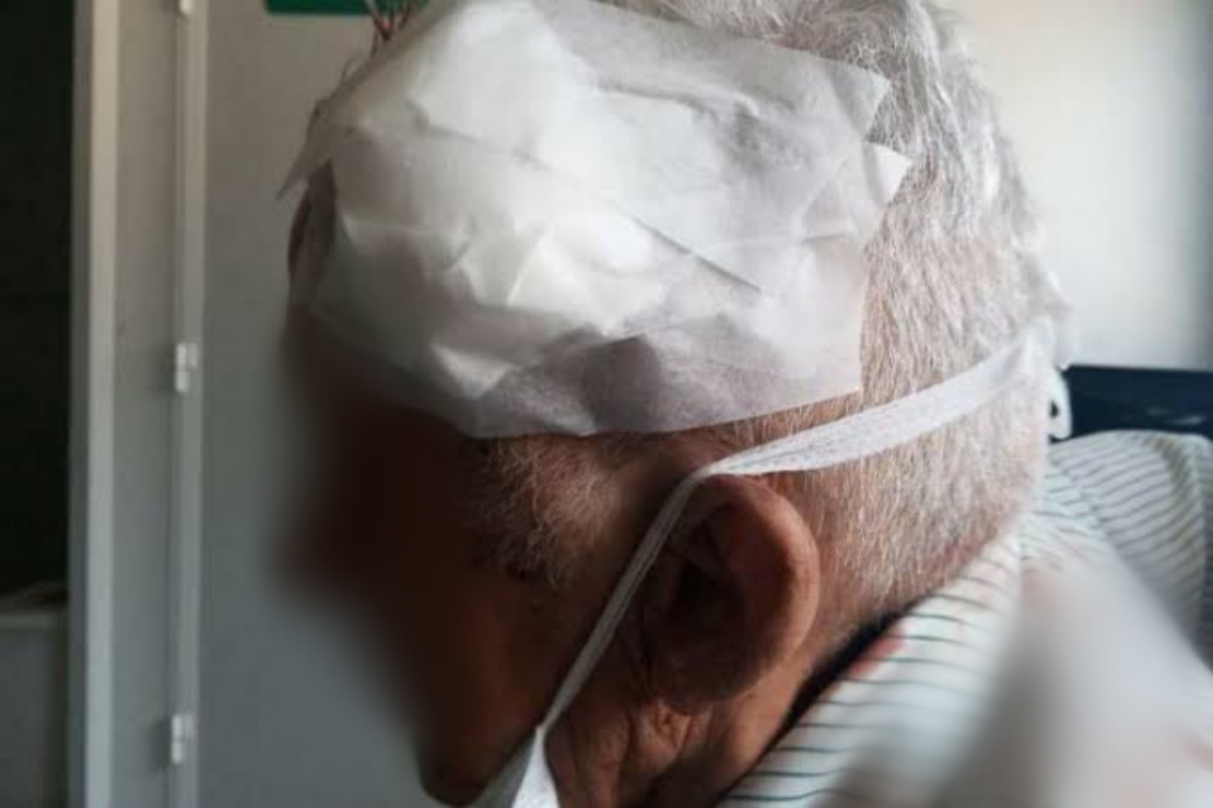 NA CABEÇA: Idoso é agredido a pedradas ao proteger filha de facção criminosa