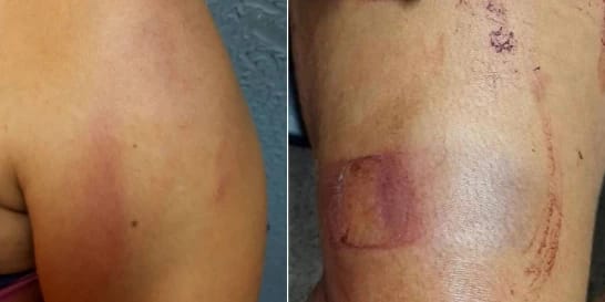 COVARDIA: Mulher leva surra ao negar sexo ao marido após bebedeira