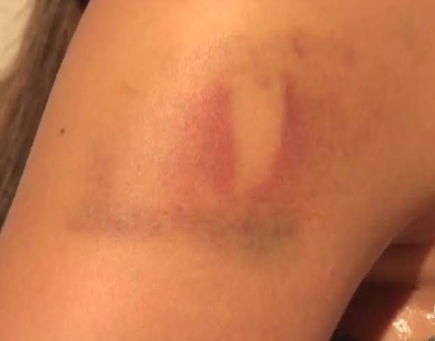 NÃO GOSTOU: Mulher leva surra do marido por questionar ao chegar bêbado em casa