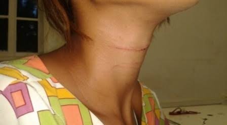 APÓS DISCUSSÃO: Marido é preso por agredir e ameaçar matar esposa com facada no pescoço