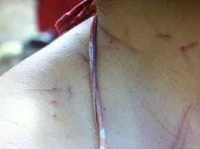 DISCUSSÃO BANAL: Marido violento espanca e tenta matar mulher estrangulada