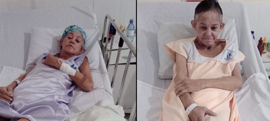 APELO: Senhora pede ajuda para custear tratamento nos pulmões