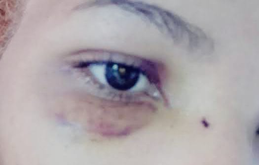 'VALENTÃO': Lutador de MMA é acusado de espancar a namorada e cunhada após invadir casa