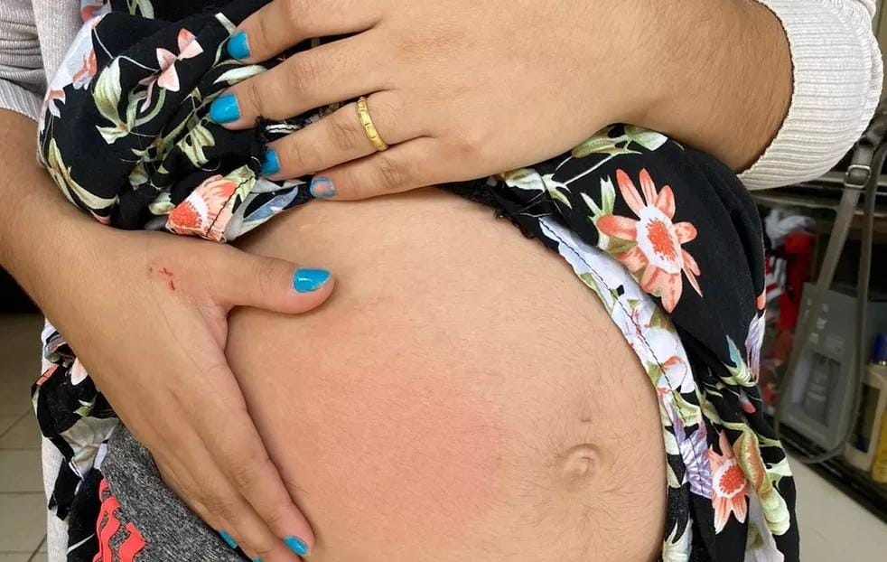 ATAQUE DE FÚRIA: Sogra entra na briga de casal e espanca a nora grávida 