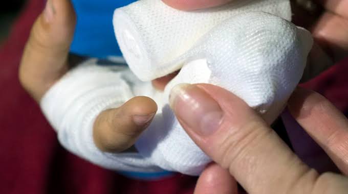 TORTURADOS: Trabalhadores têm dedos decepados durante assalto 