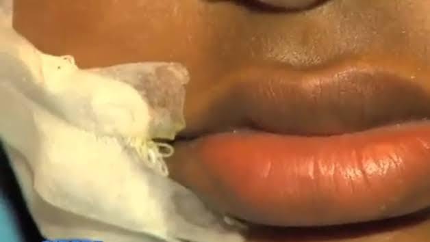 NO ROSTO: Homem chega em casa com amiga e namorada usa gilete para atacá-lo