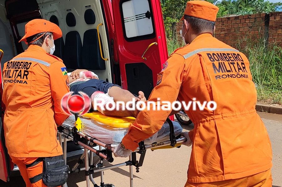 SE DEU MAL: Criminoso é preso após roubar moto e sofrer grave acidente