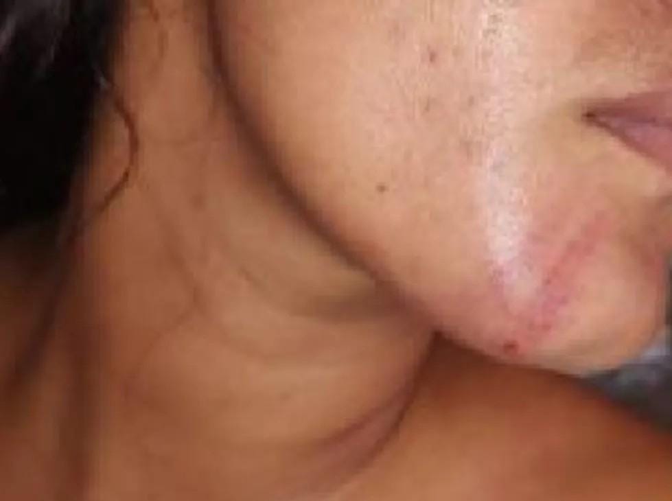 'VOU EMBORA': Mulher é surrada pelo marido após exigir a separação 