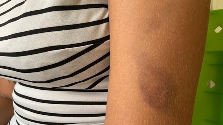 COVARDIA: Menina de 13 anos é espancada e roubada por criminoso na zona Sul