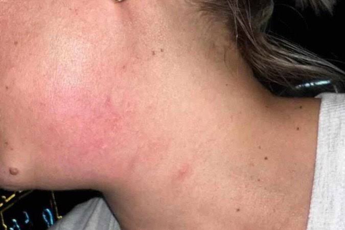 NA MADRUGADA: Mãe é acordada e agredida  pelo filho em busca de dinheiro para droga 