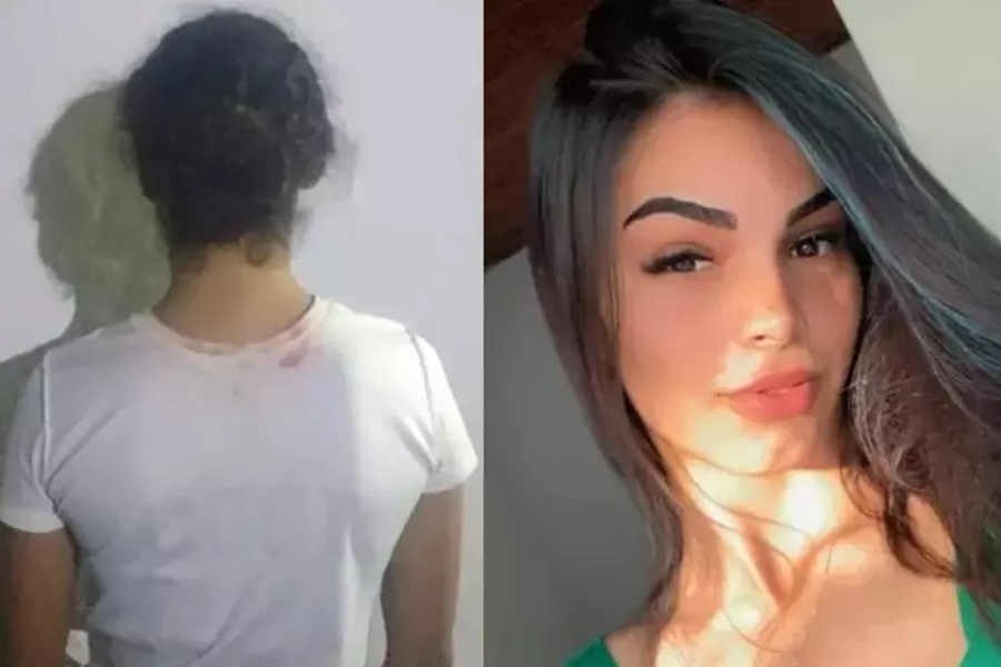 CIÚMES: Mulher é presa pela PM suspeita de ter atacado a jovem com ácido; veja vídeo 