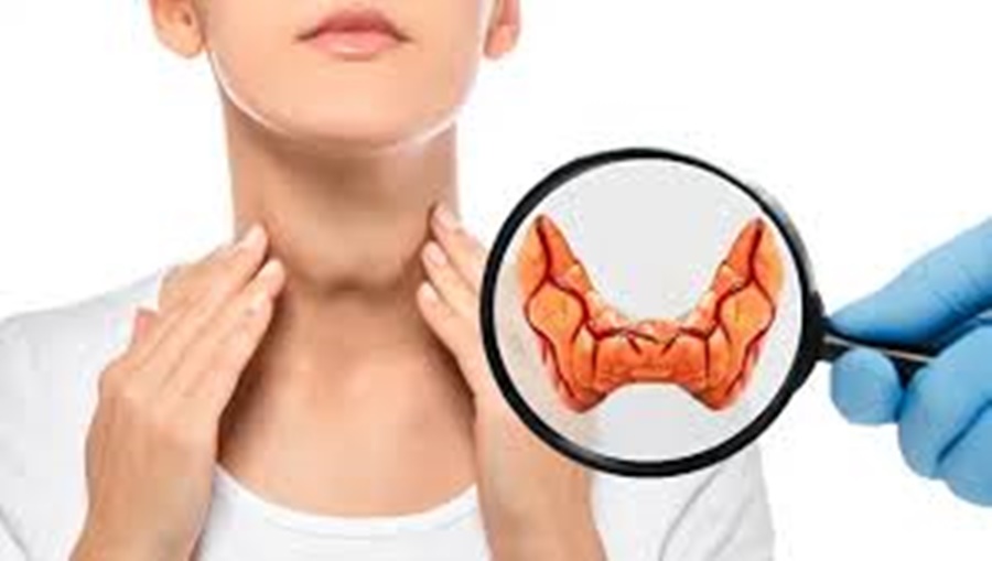 SAÚDE E BEM ESTAR: Hipertireoidismo e Hipotireoidismo entenda as causas, sintomas e tratamentos