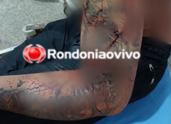 NA FESTA: Jovem é alvo de tentativa de homicídio por negar ter relação com aniversariante 