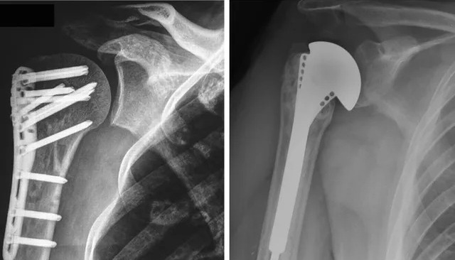 SAÚDE PÚBLICA: 'Isso é um descaso', diz pai de jovem internado no Hospital de Base