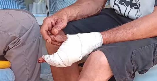 'NÓINHA' FUGIU: Homem tem mão quase decepada a facãozada em distribuidora 