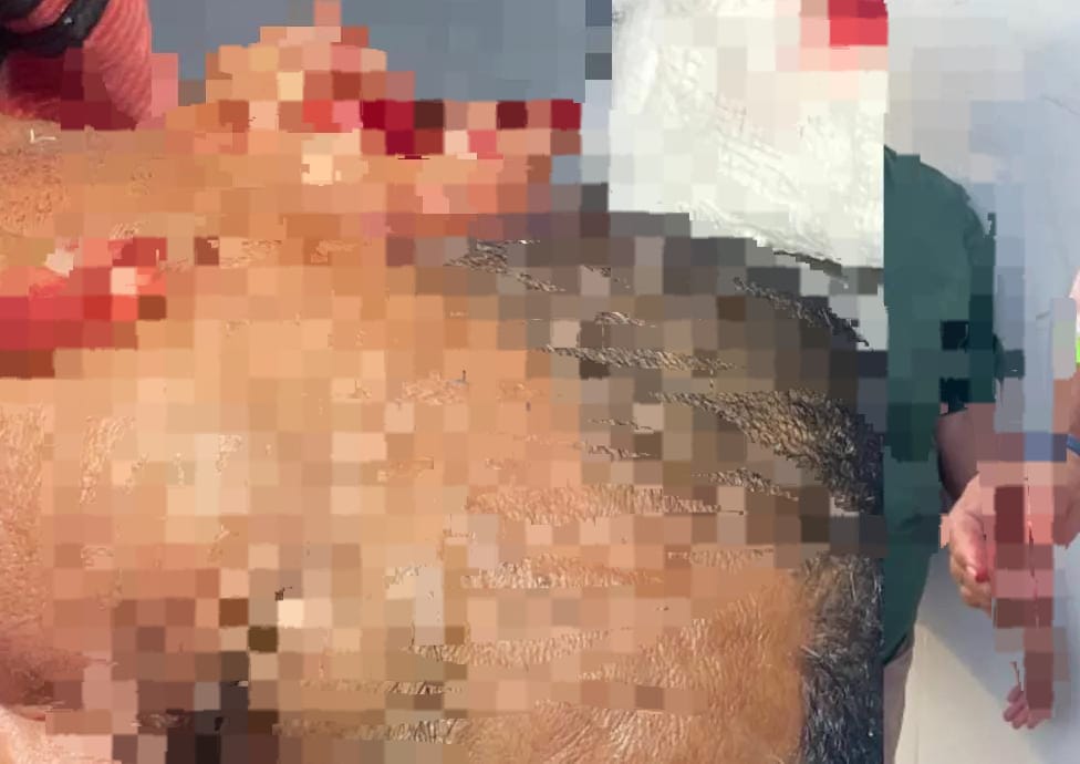 CAMPO DE FUTEBOL: Mecânico tem parte da orelha cortada após briga com vulgo 'Calcinha'