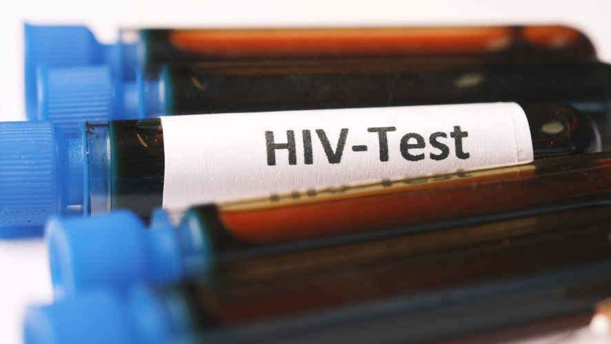 ESTUDO INDICA: Um terço dos jovens que fazem sexo com outros homens nunca fizeram teste de HIV 